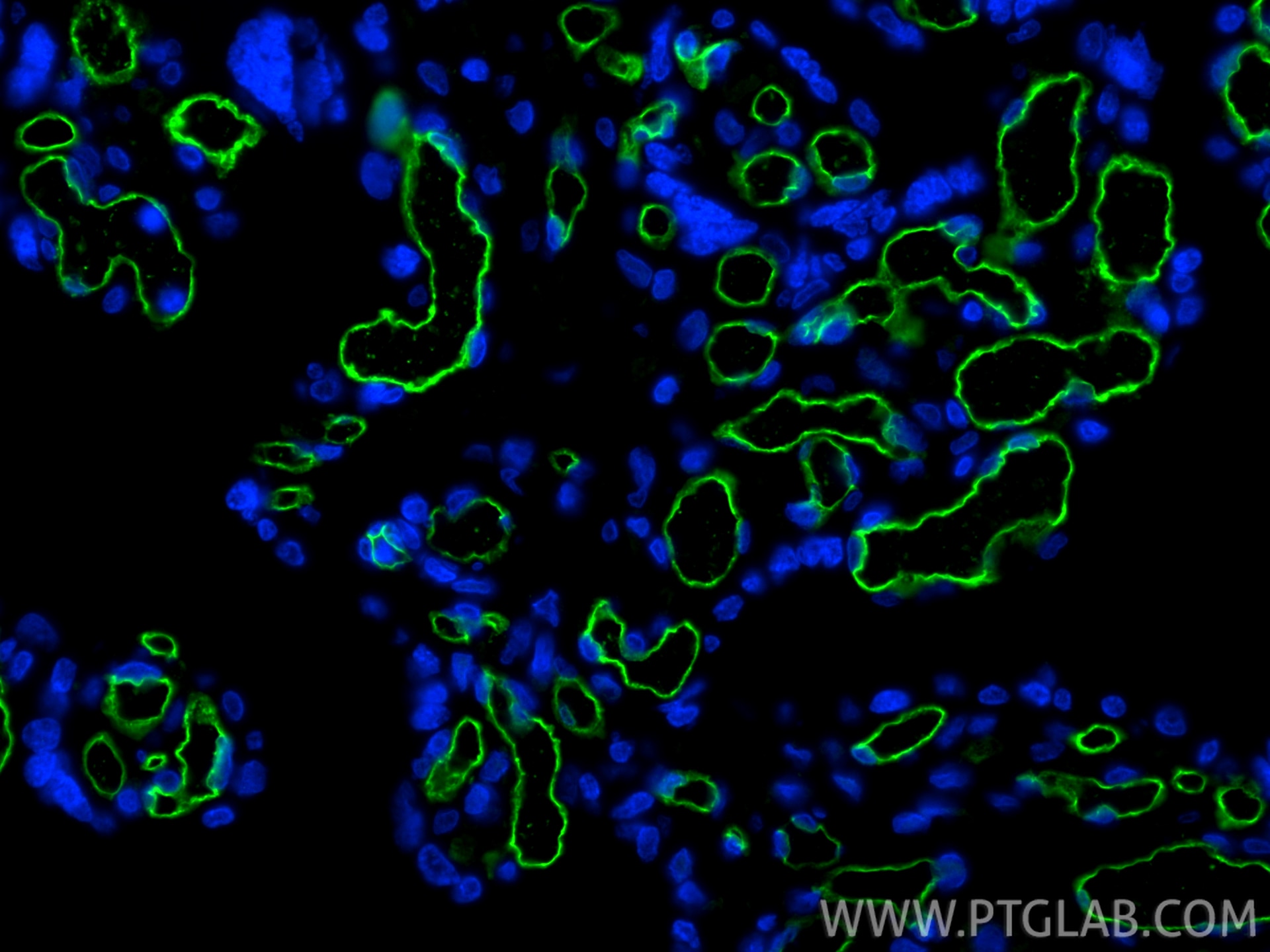Immunofluorescence (IF) / fluorescent staining of human placenta tissue using CD34 Monoclonal antibody (60180-1-Ig)