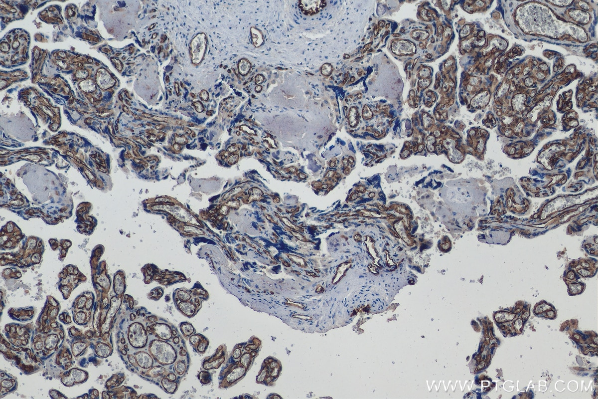 Immunohistochemistry (IHC) staining of human placenta tissue using CD34 Monoclonal antibody (60180-1-Ig)