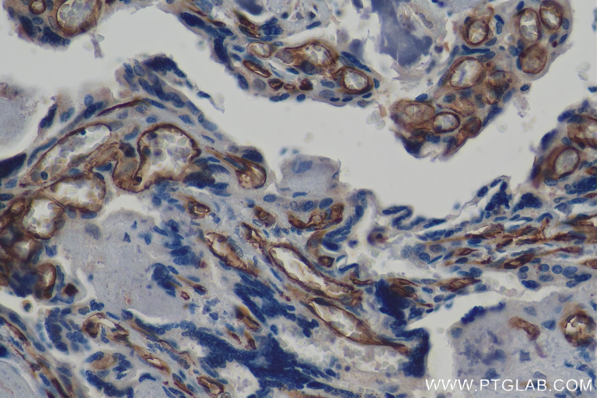 Immunohistochemistry (IHC) staining of human placenta tissue using CD34 Monoclonal antibody (60180-1-Ig)