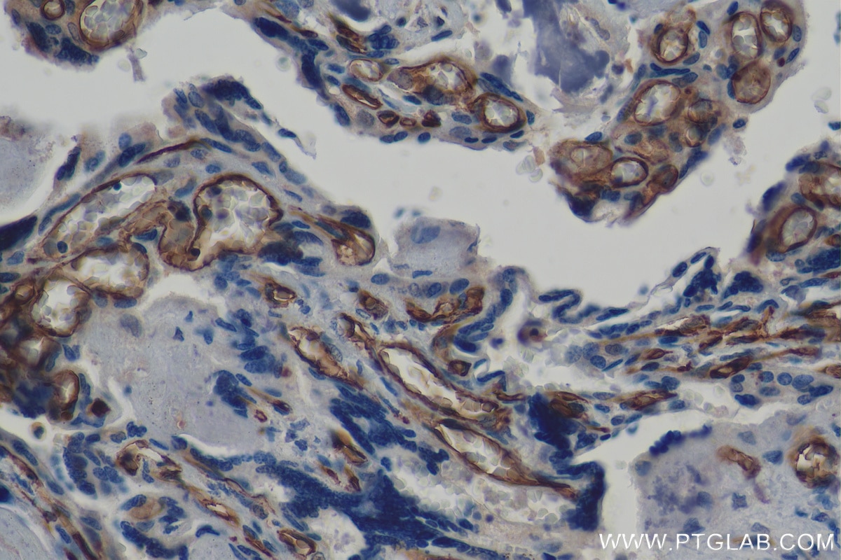 IHC staining of human placenta using 60180-1-Ig