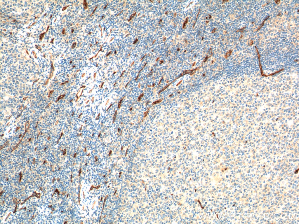 CD34 Monoclonal antibody