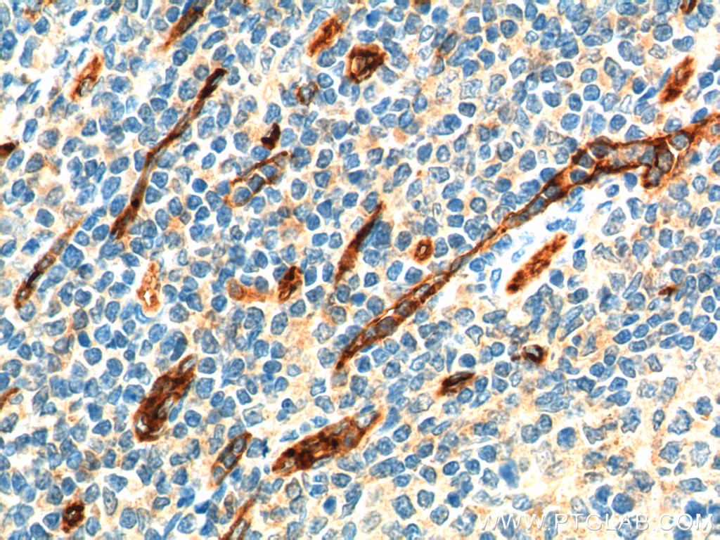 CD34 Monoclonal antibody