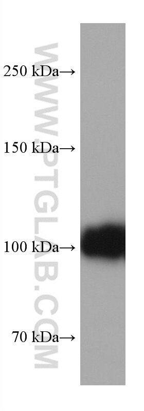 Western Blot (WB) analysis of human placenta tissue using CD34 Monoclonal antibody (60180-1-Ig)