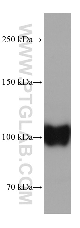 Western Blot (WB) analysis of human uterus tissue using CD34 Monoclonal antibody (60180-1-Ig)