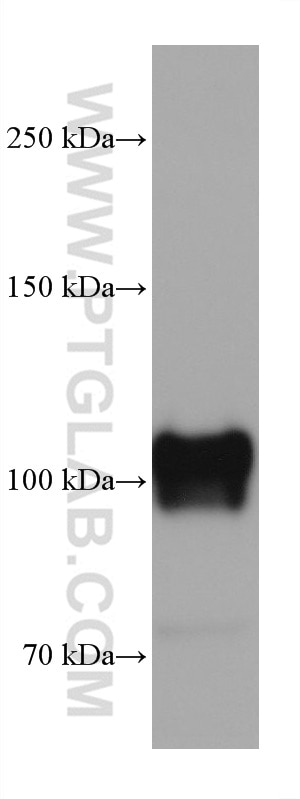 Western Blot (WB) analysis of human testis tissue using CD34 Monoclonal antibody (60180-1-Ig)