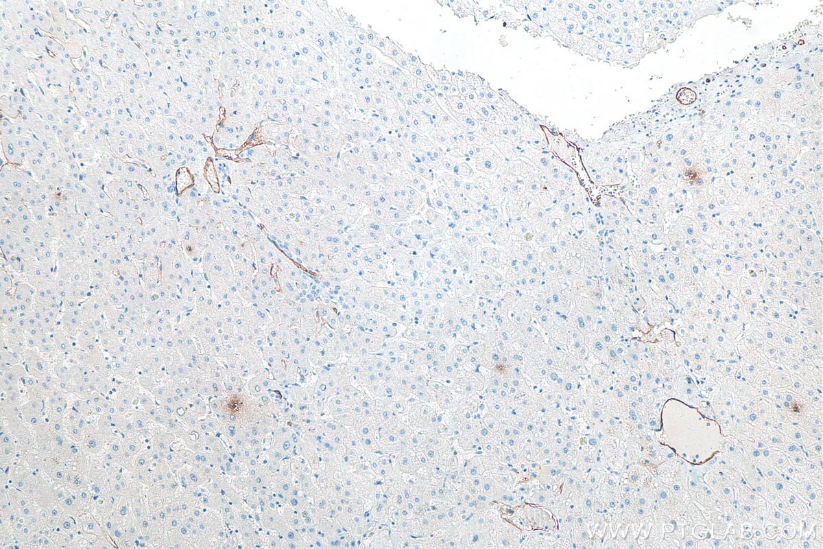 Immunohistochemistry (IHC) staining of human liver tissue using CD34 Monoclonal antibody (60180-2-Ig)