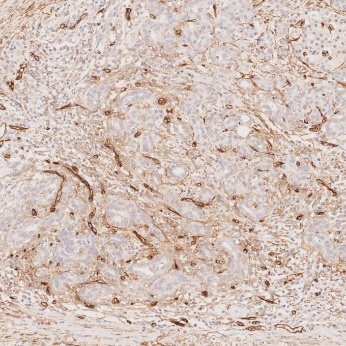 Immunohistochemistry (IHC) staining of human pancreas tissue using CD34 Monoclonal antibody (60180-2-Ig)