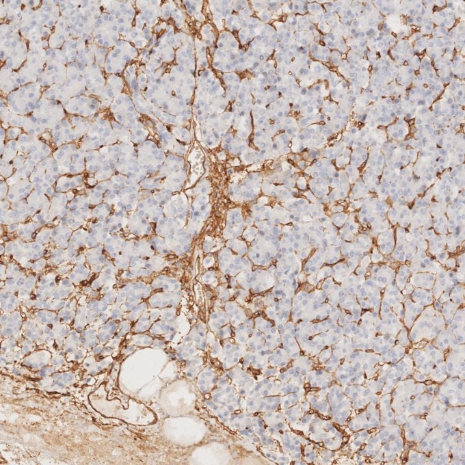 Immunohistochemistry (IHC) staining of human pancreas tissue using CD34 Monoclonal antibody (60180-2-Ig)