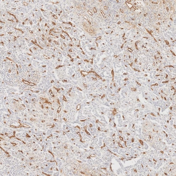 Immunohistochemistry (IHC) staining of human liver tissue using CD34 Monoclonal antibody (60180-2-Ig)
