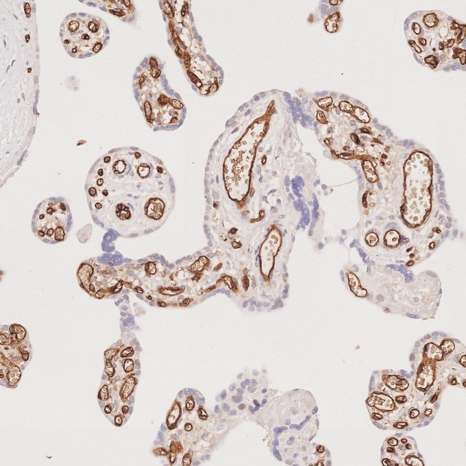 Immunohistochemistry (IHC) staining of human placenta tissue using CD34 Monoclonal antibody (60180-2-Ig)