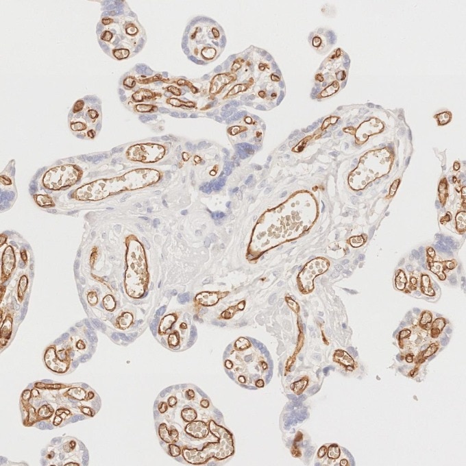 Immunohistochemistry (IHC) staining of human placenta tissue using CD34 Monoclonal antibody (60180-2-Ig)