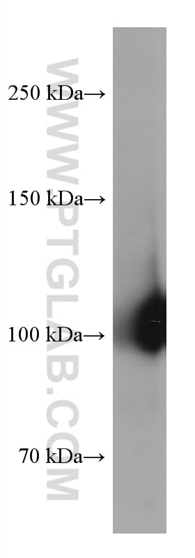 Western Blot (WB) analysis of human ovary cancer cells using CD34 Monoclonal antibody (60180-2-Ig)