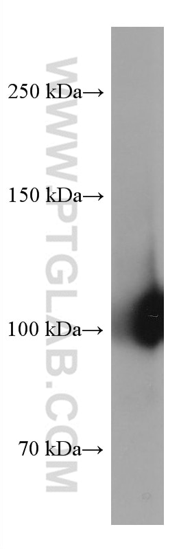 WB analysis of human ovary cancer using 60180-2-Ig