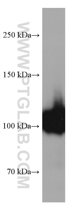 Western Blot (WB) analysis of human placenta tissue using CD34 Monoclonal antibody (60180-2-Ig)