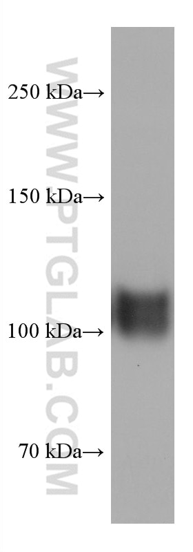 Western Blot (WB) analysis of human uterus tissue using CD34 Monoclonal antibody (60180-2-Ig)