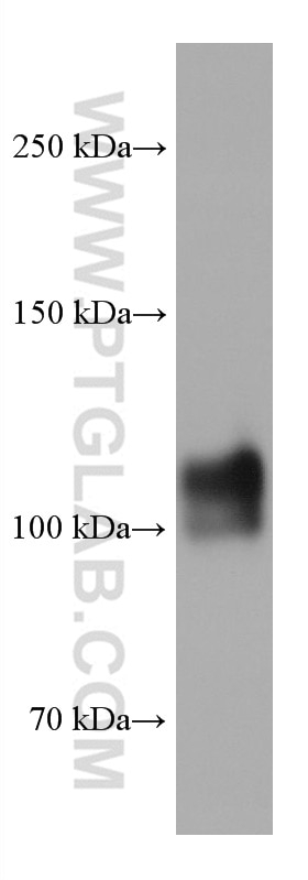 Western Blot (WB) analysis of human testis tissue using CD34 Monoclonal antibody (60180-2-Ig)