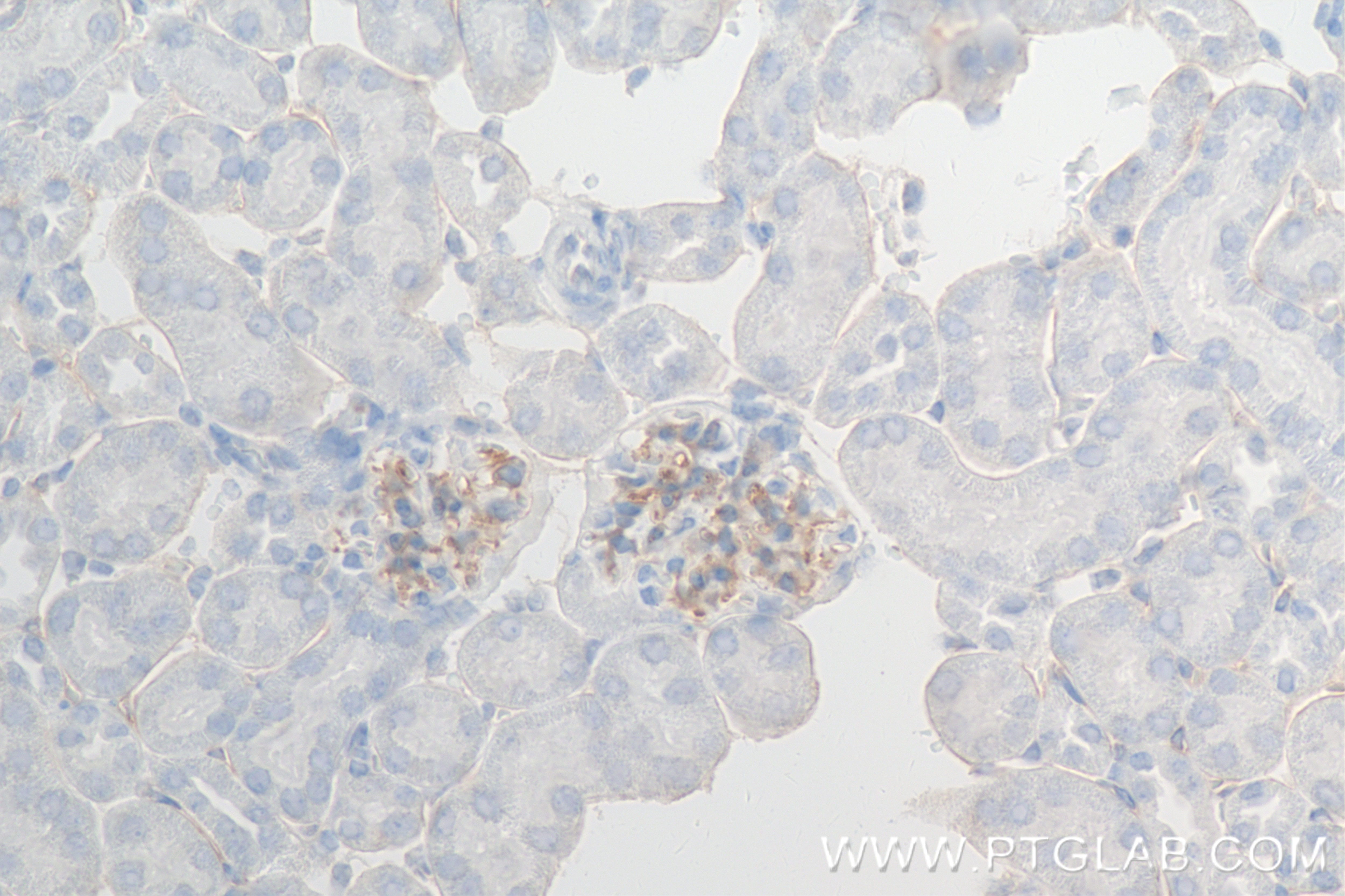 Immunohistochemistry (IHC) staining of mouse kidney tissue using CD34 Recombinant monoclonal antibody (83713-2-RR)