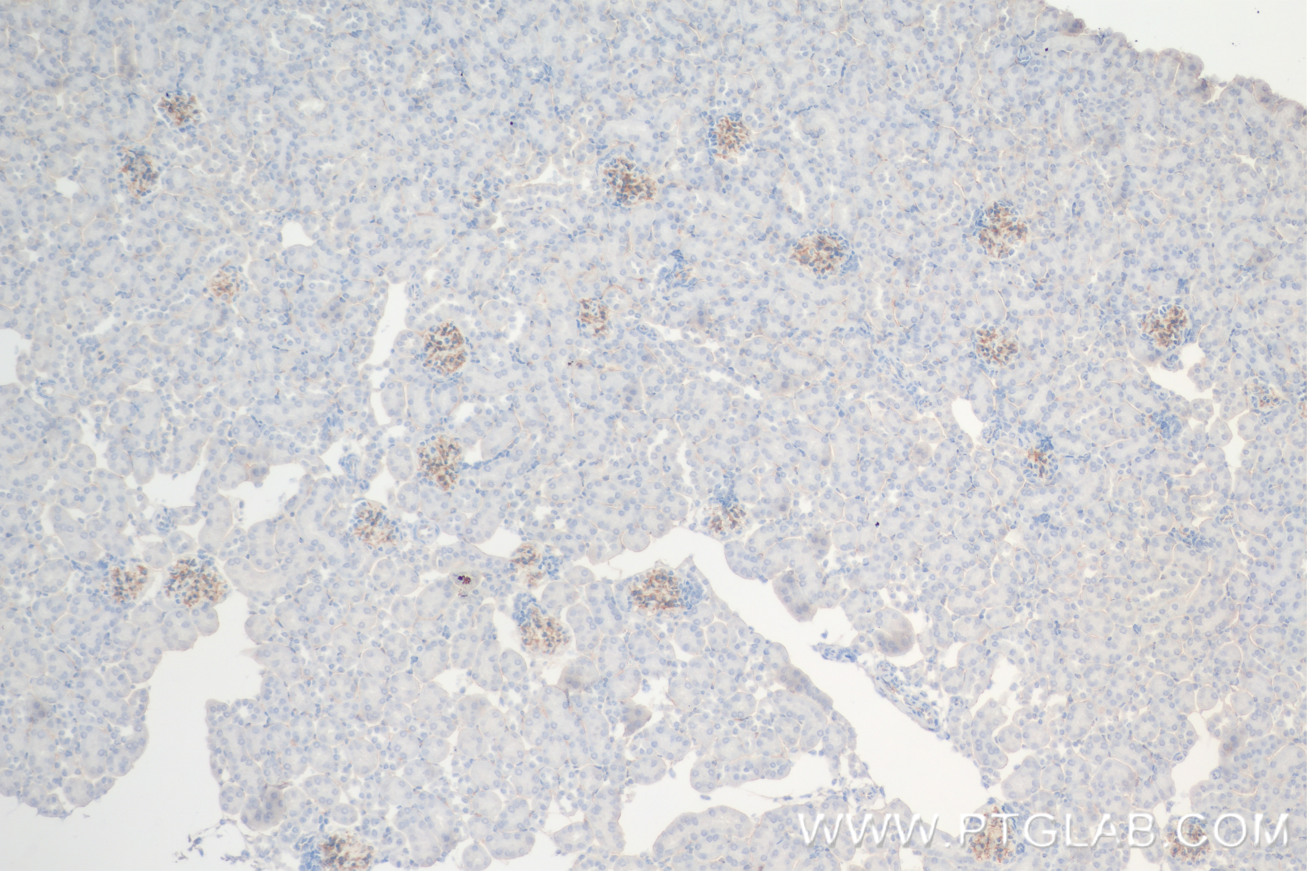 Immunohistochemistry (IHC) staining of mouse kidney tissue using CD34 Recombinant monoclonal antibody (83713-2-RR)