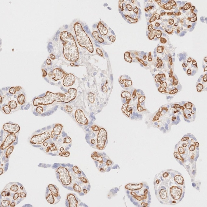 Immunohistochemistry (IHC) staining of human placenta tissue using CD34 Recombinant monoclonal antibody (84242-5-RR)