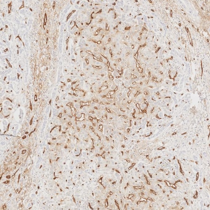 Immunohistochemistry (IHC) staining of human liver tissue using CD34 Recombinant monoclonal antibody (84242-5-RR)