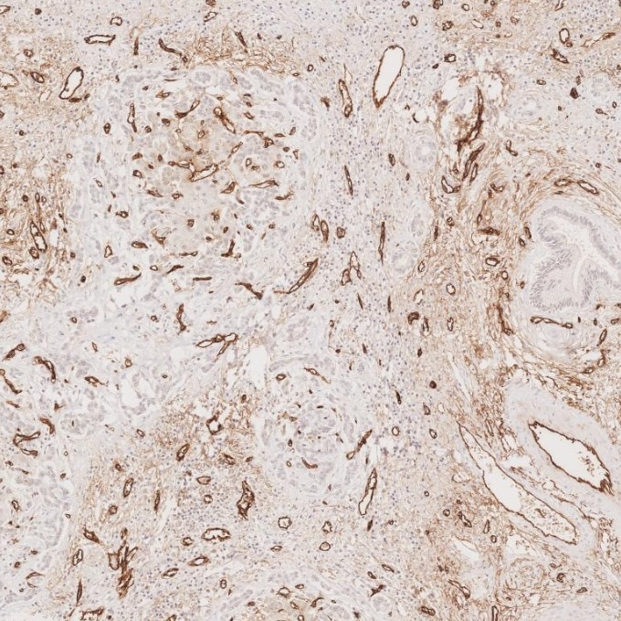 Immunohistochemistry (IHC) staining of human liver tissue using CD34 Recombinant monoclonal antibody (84242-5-RR)