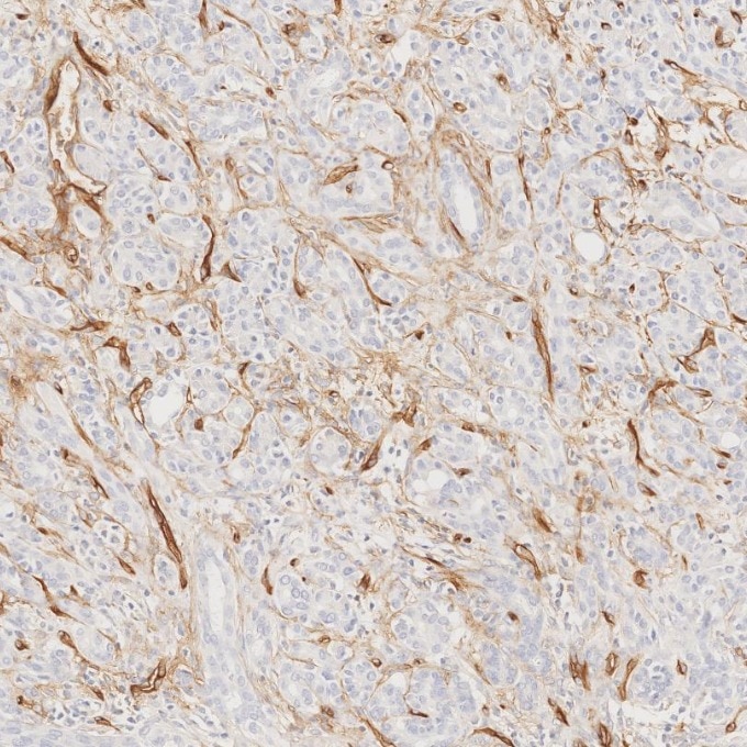 Immunohistochemistry (IHC) staining of human pancreas tissue using CD34 Recombinant monoclonal antibody (84242-5-RR)