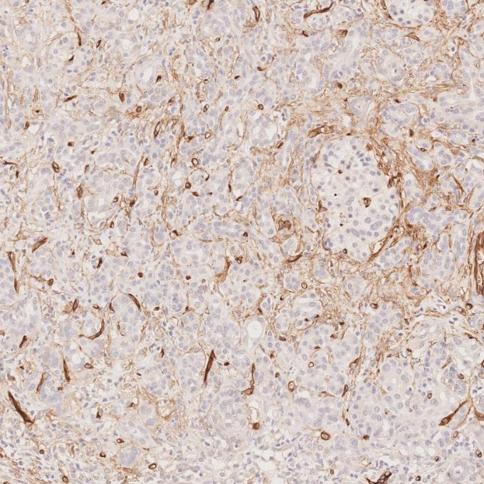 Immunohistochemistry (IHC) staining of human pancreas tissue using CD34 Recombinant monoclonal antibody (84242-5-RR)