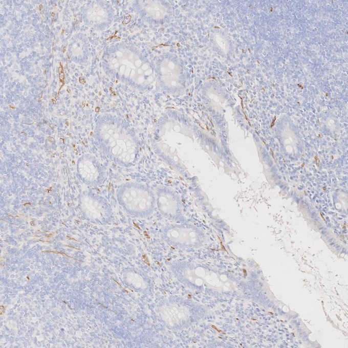 Immunohistochemistry (IHC) staining of human appendicitis tissue using CD34 Recombinant monoclonal antibody (84242-5-RR)