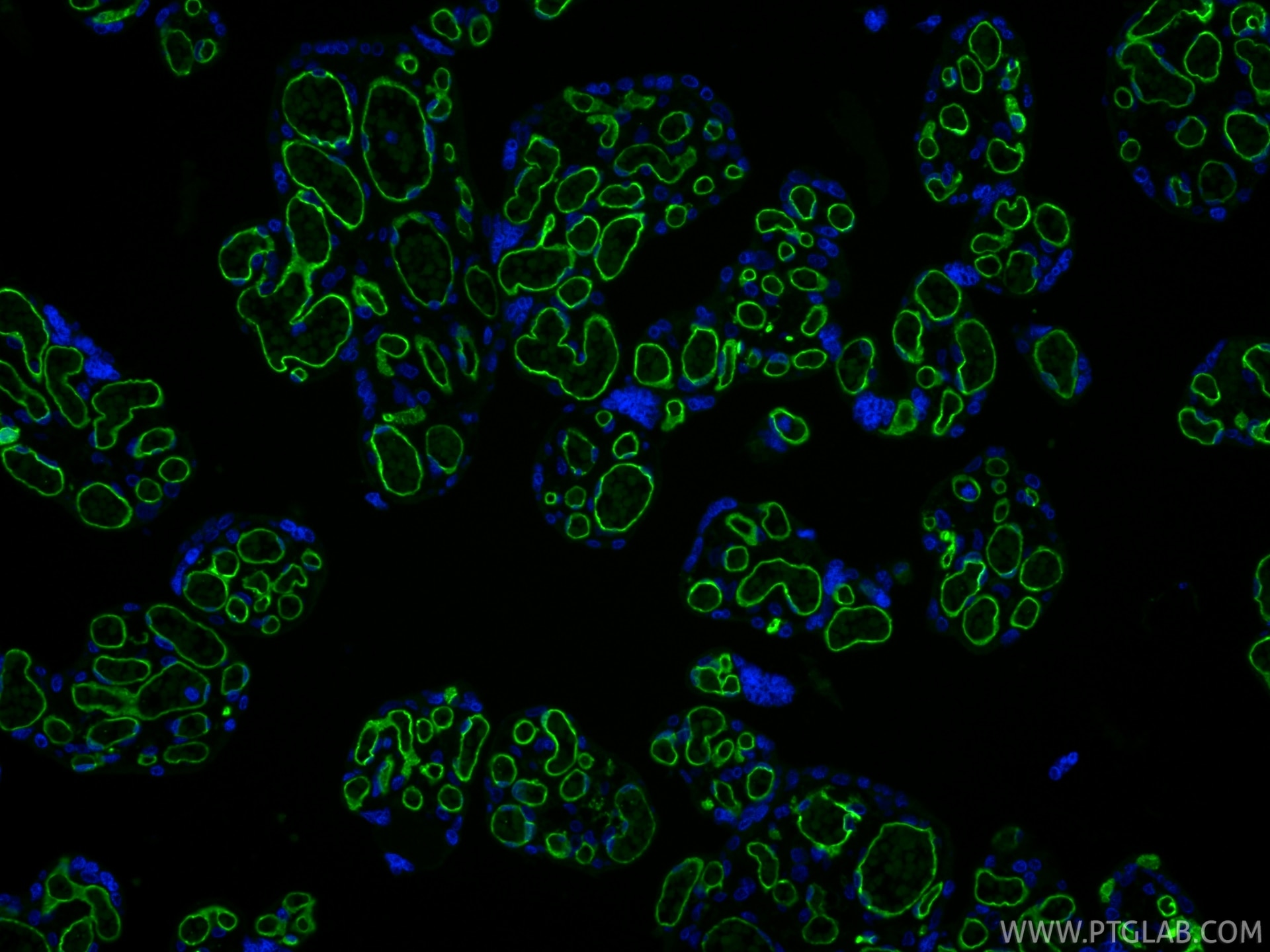 IF Staining of human placenta using 98145-4-RR Immunofluorescence (IF) / fluorescent staining of human placenta tissue using Anti-Human CD34 Rabbit Recombinant Antibody (98145-4-RR)