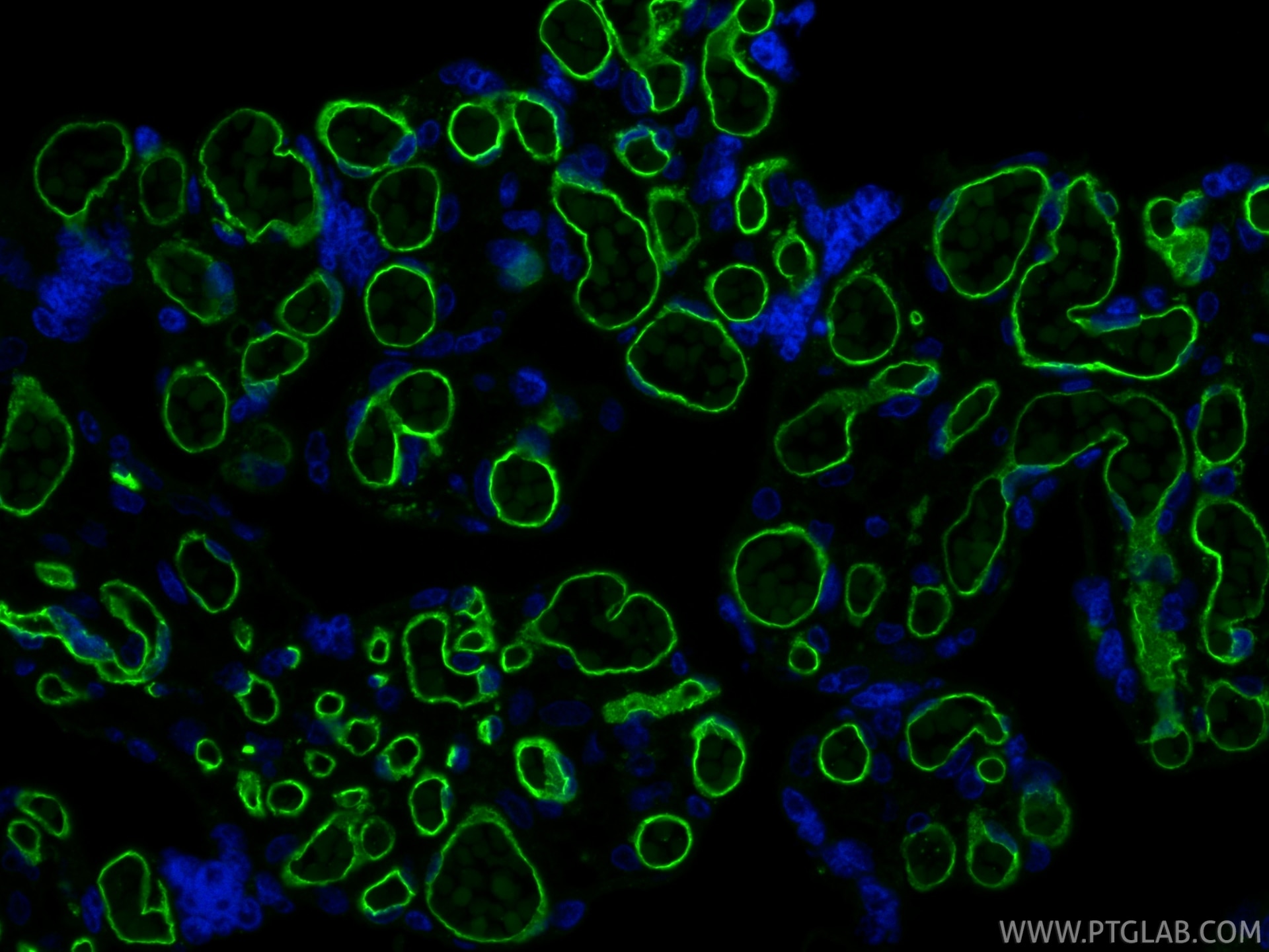 IF Staining of human placenta using 98145-4-RR Immunofluorescence (IF) / fluorescent staining of human placenta tissue using Anti-Human CD34 Rabbit Recombinant Antibody (98145-4-RR)