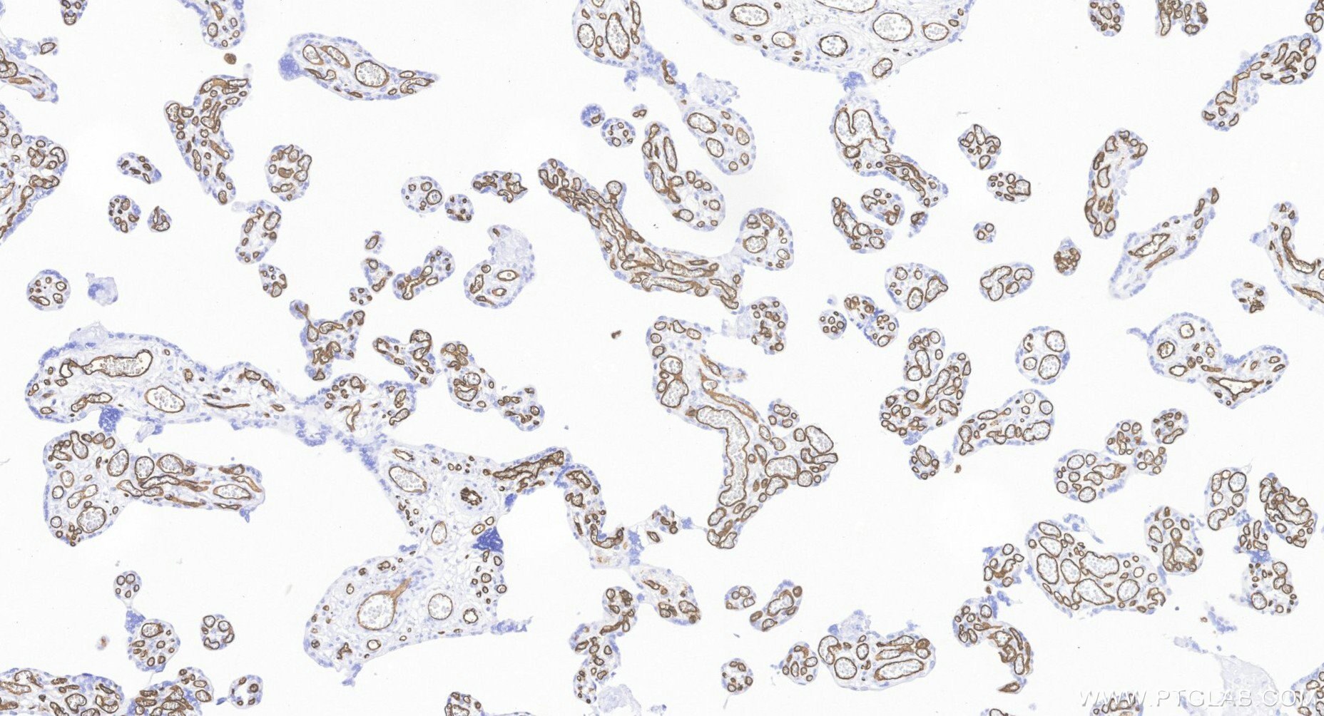 IHC staining of human placenta using BK00003 Immunohistochemistry (IHC) staining of human placenta tissue using LE/AF Purified Rabbit Anti-Human CD34 Antibody (BK00003)