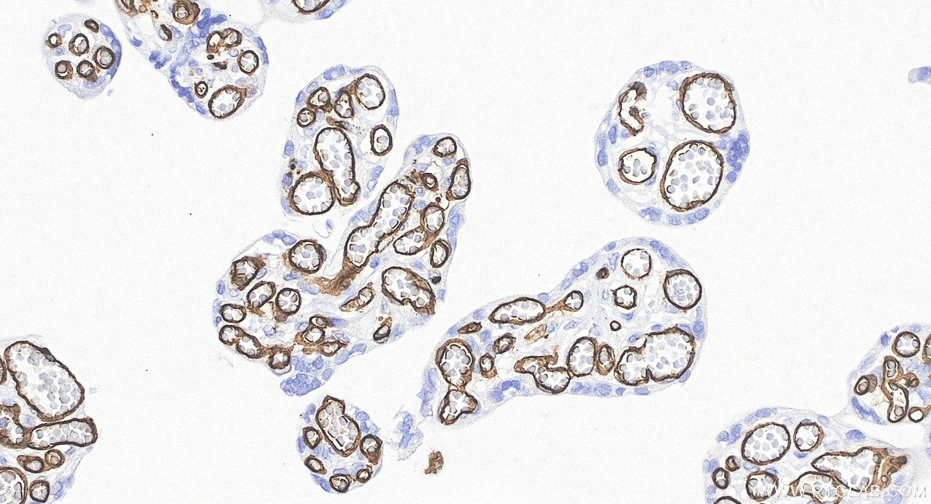 IHC staining of human placenta using BK00003 Immunohistochemistry (IHC) staining of human placenta tissue using LE/AF Purified Rabbit Anti-Human CD34 Antibody (BK00003)