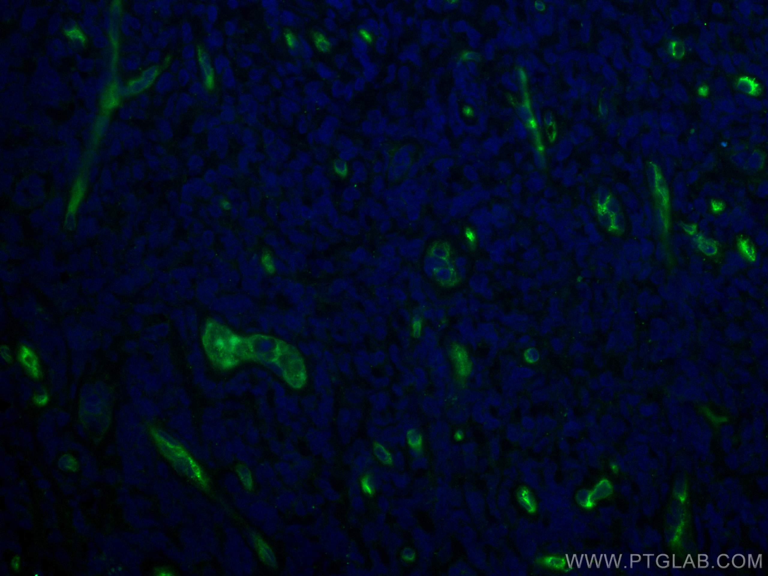 Immunofluorescence (IF) / fluorescent staining of human tonsillitis tissue using CoraLite® Plus 488-conjugated CD34 Monoclonal anti (CL488-60180)