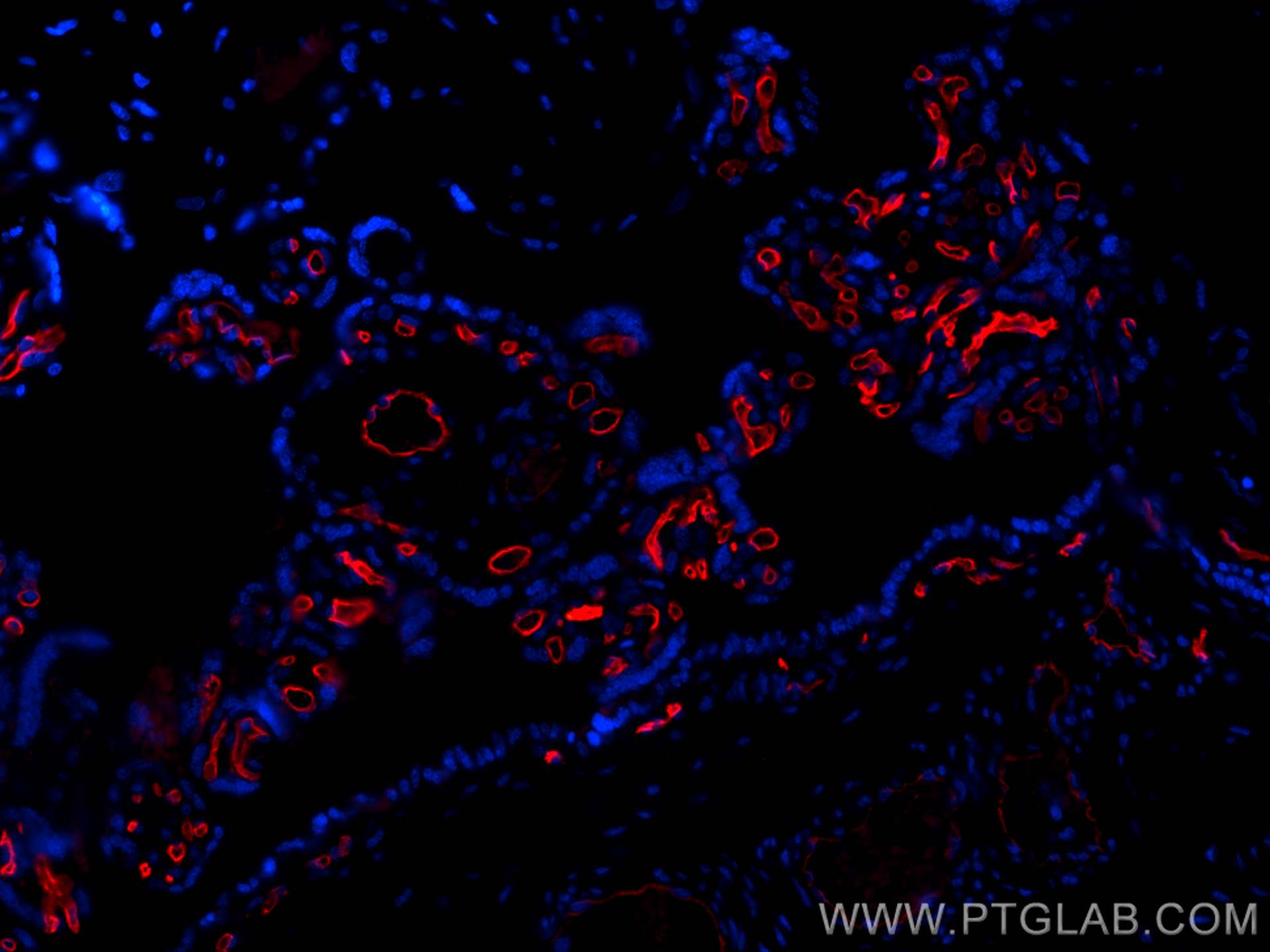 IF Staining of human placenta using CL594-14486