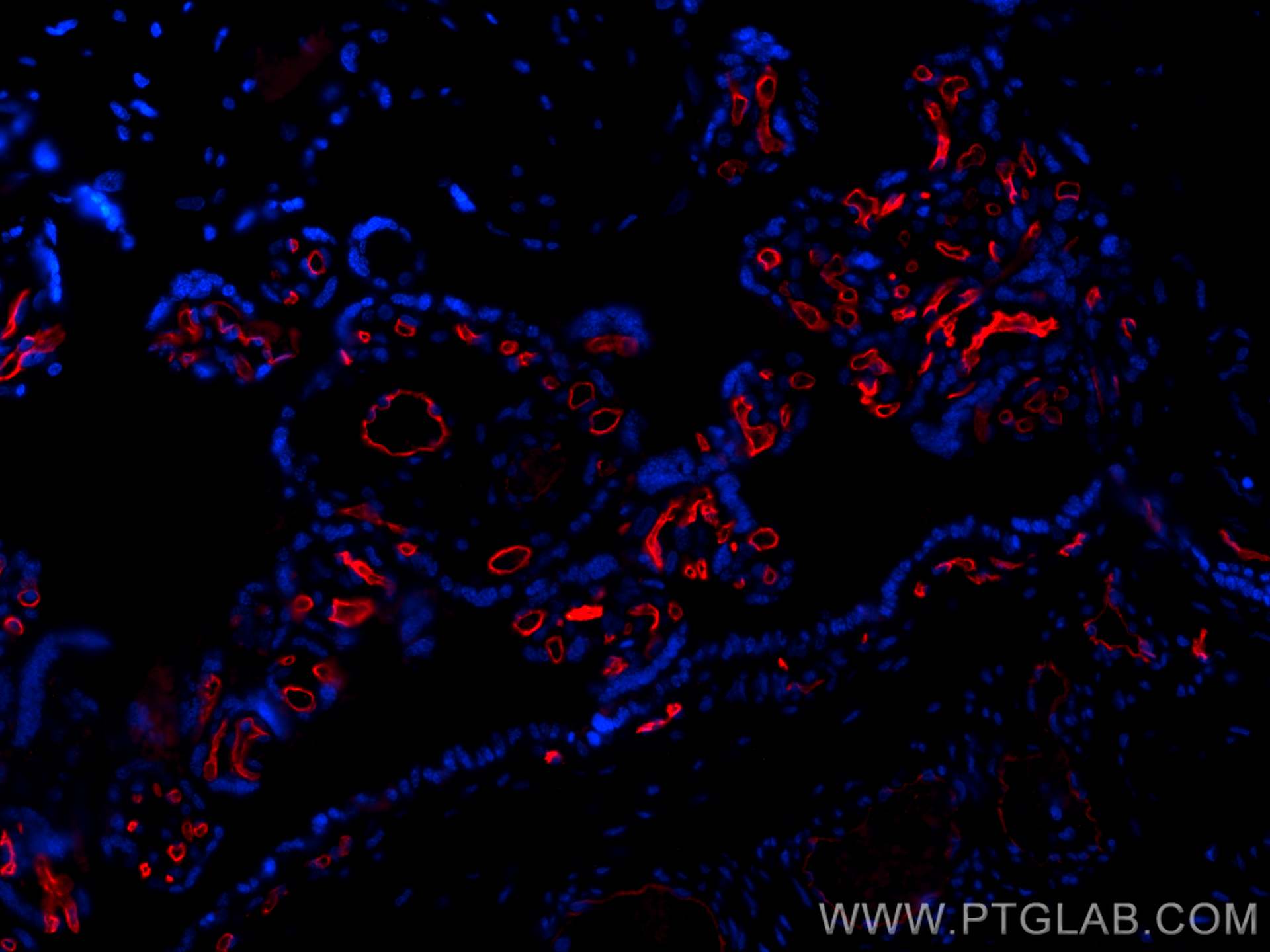 Immunofluorescence (IF) / fluorescent staining of human placenta tissue using CoraLite®594-conjugated CD34 Polyclonal antibody (CL594-14486)