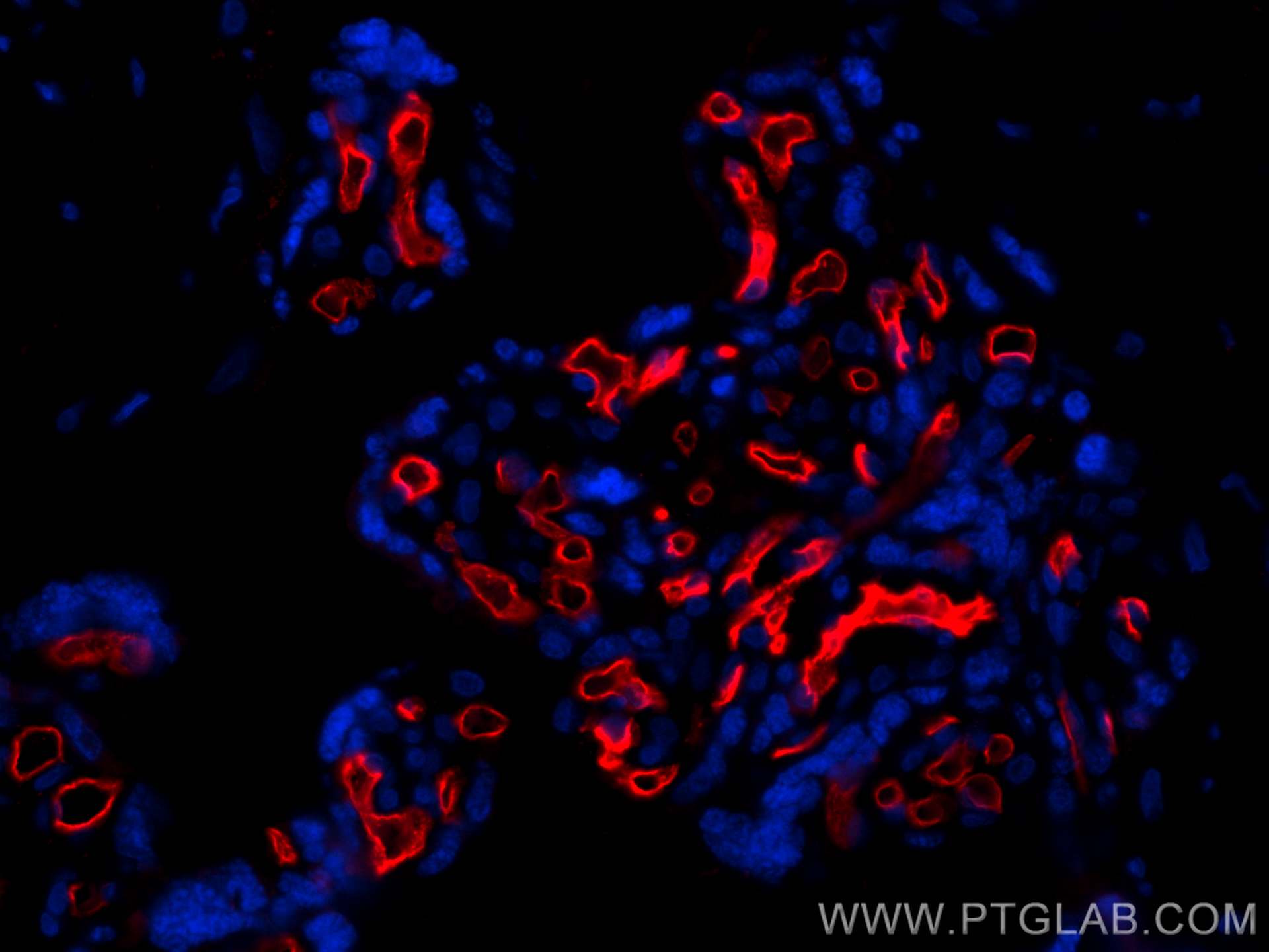 Immunofluorescence (IF) / fluorescent staining of human placenta tissue using CoraLite®594-conjugated CD34 Polyclonal antibody (CL594-14486)