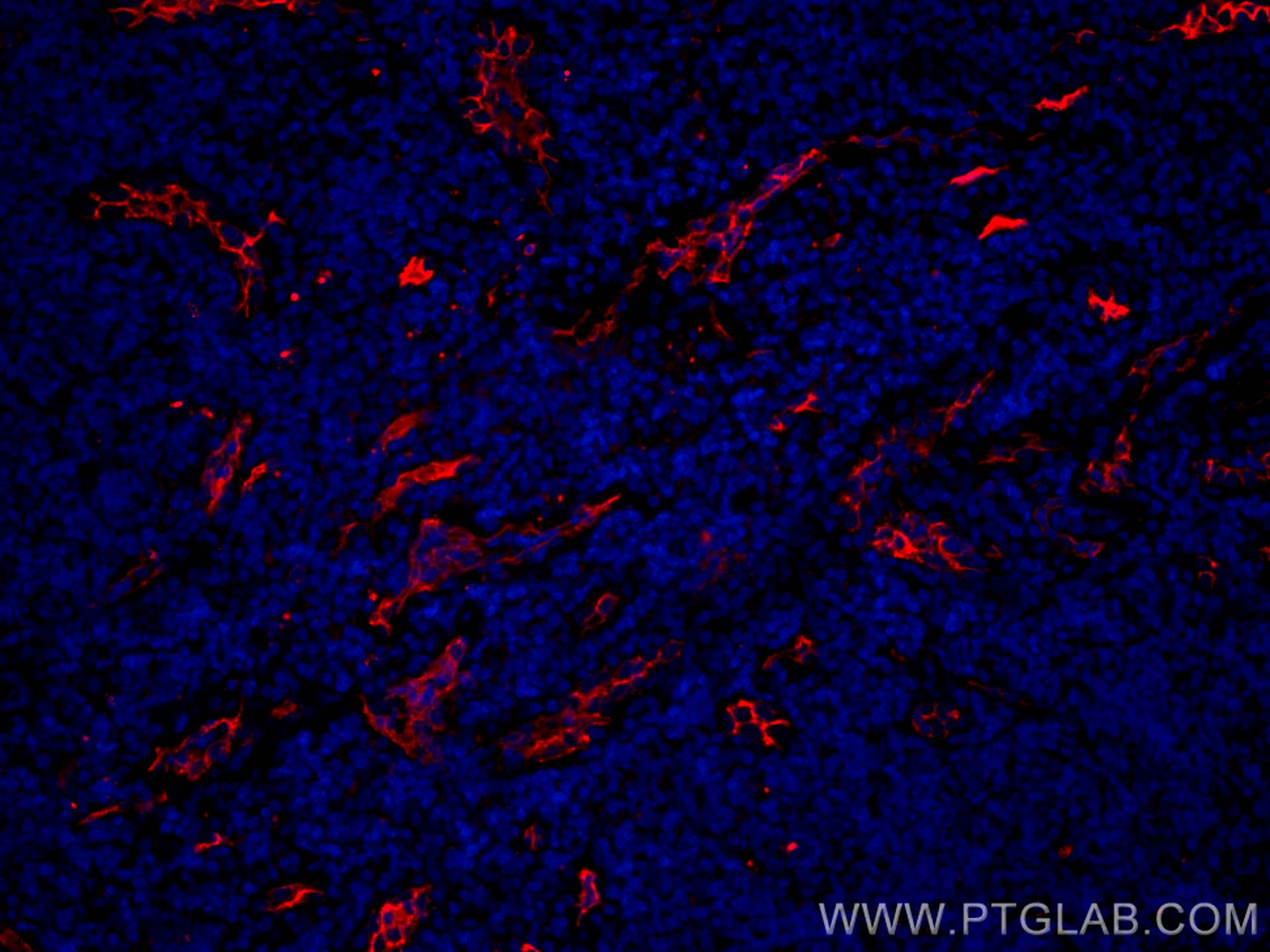 Immunofluorescence (IF) / fluorescent staining of human tonsillitis tissue using CoraLite®594-conjugated CD34 Polyclonal antibody (CL594-14486)