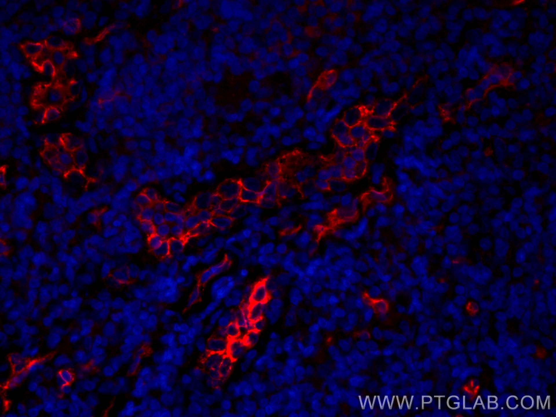 Immunofluorescence (IF) / fluorescent staining of human tonsillitis tissue using CoraLite®594-conjugated CD34 Polyclonal antibody (CL594-14486)