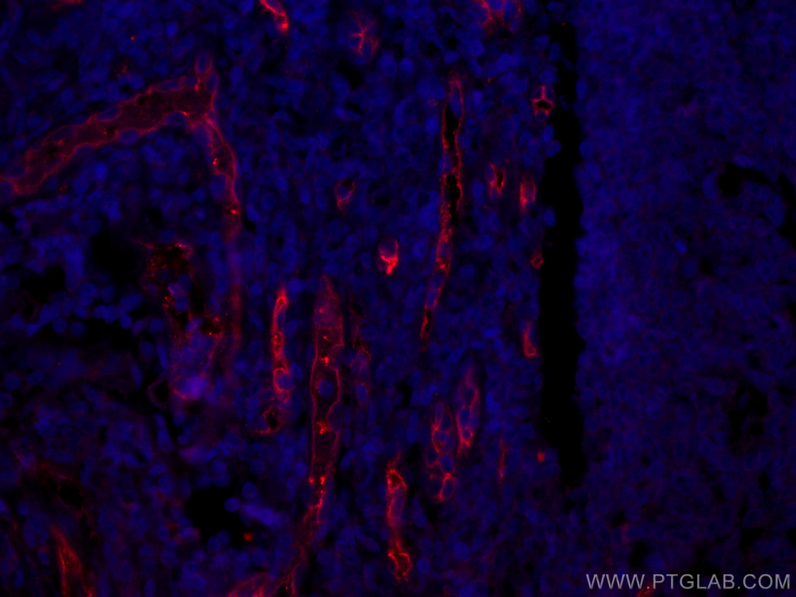 Immunofluorescence (IF) / fluorescent staining of human tonsillitis tissue using CoraLite®594-conjugated CD34 Monoclonal antibody (CL594-60180)