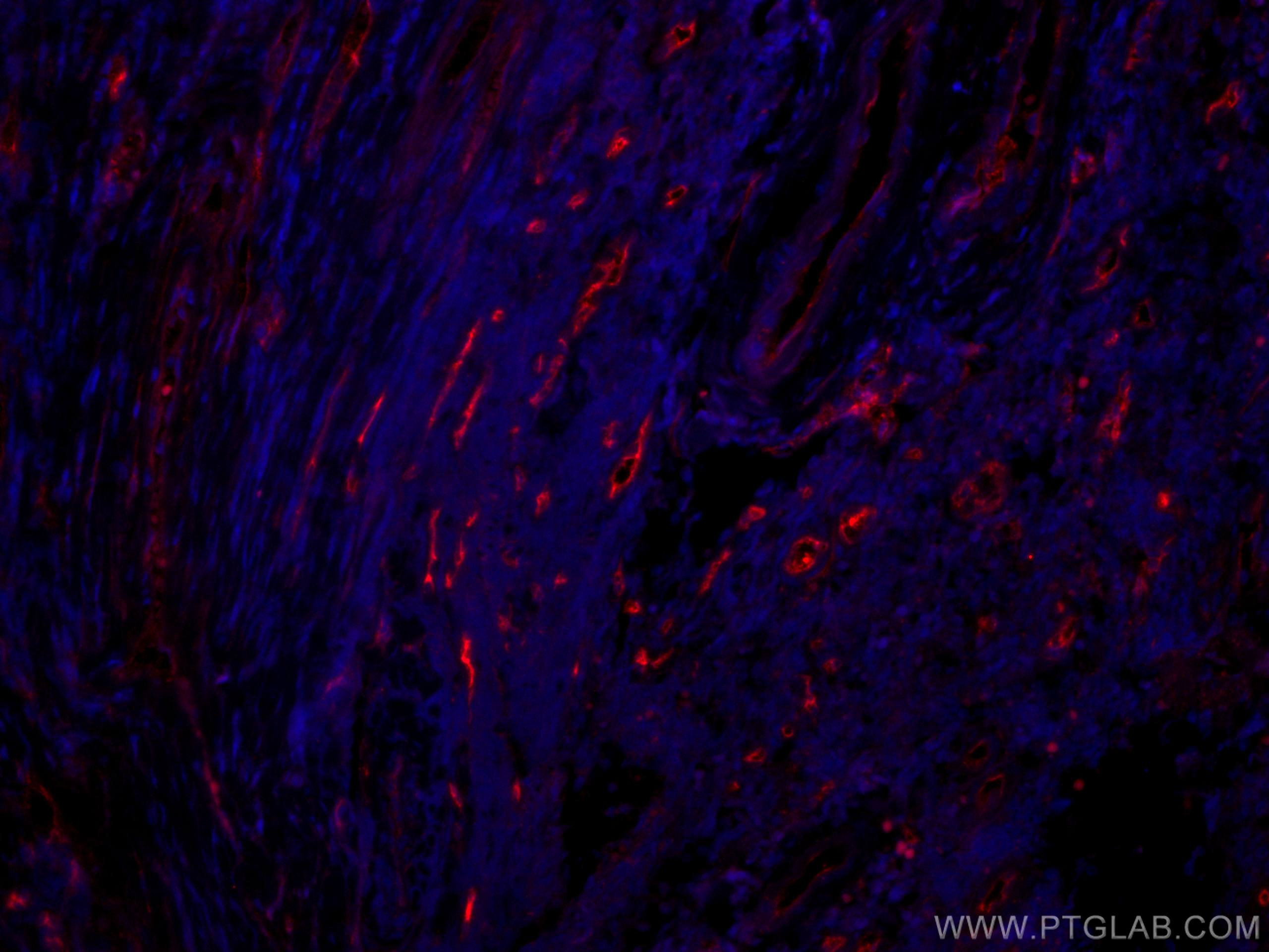 Immunofluorescence (IF) / fluorescent staining of human tonsillitis tissue using CoraLite®594-conjugated CD34 Monoclonal antibody (CL594-60180)