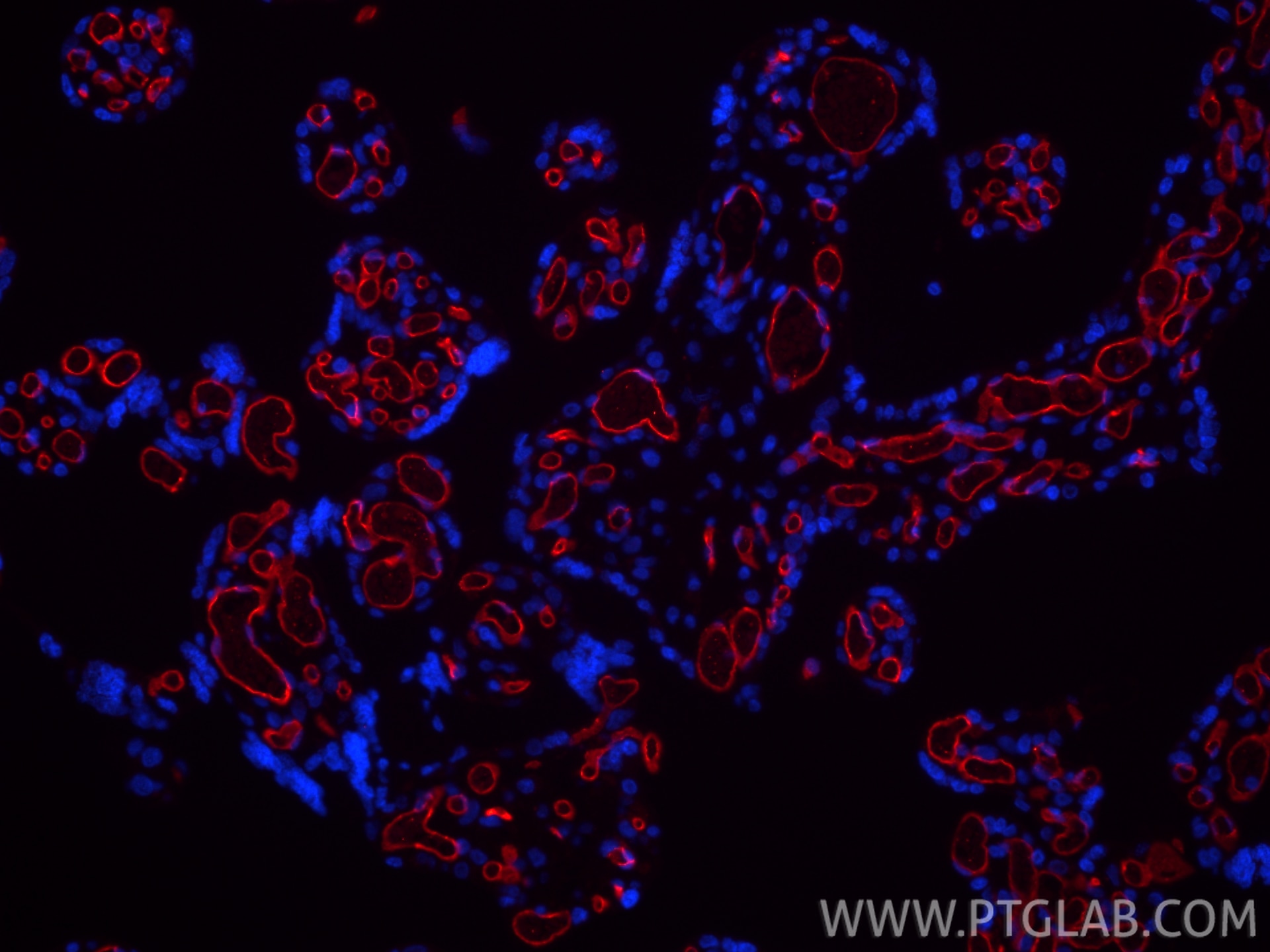 Immunofluorescence (IF) / fluorescent staining of human placenta tissue using CoraLite®594-conjugated CD34 Recombinant monoclona (CL594-84242-5)