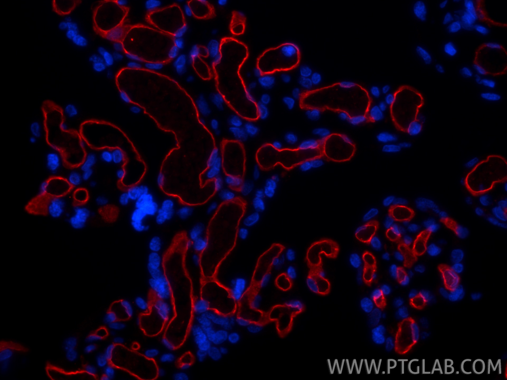 Immunofluorescence (IF) / fluorescent staining of human placenta tissue using CoraLite®594-conjugated CD34 Recombinant monoclona (CL594-84242-5)
