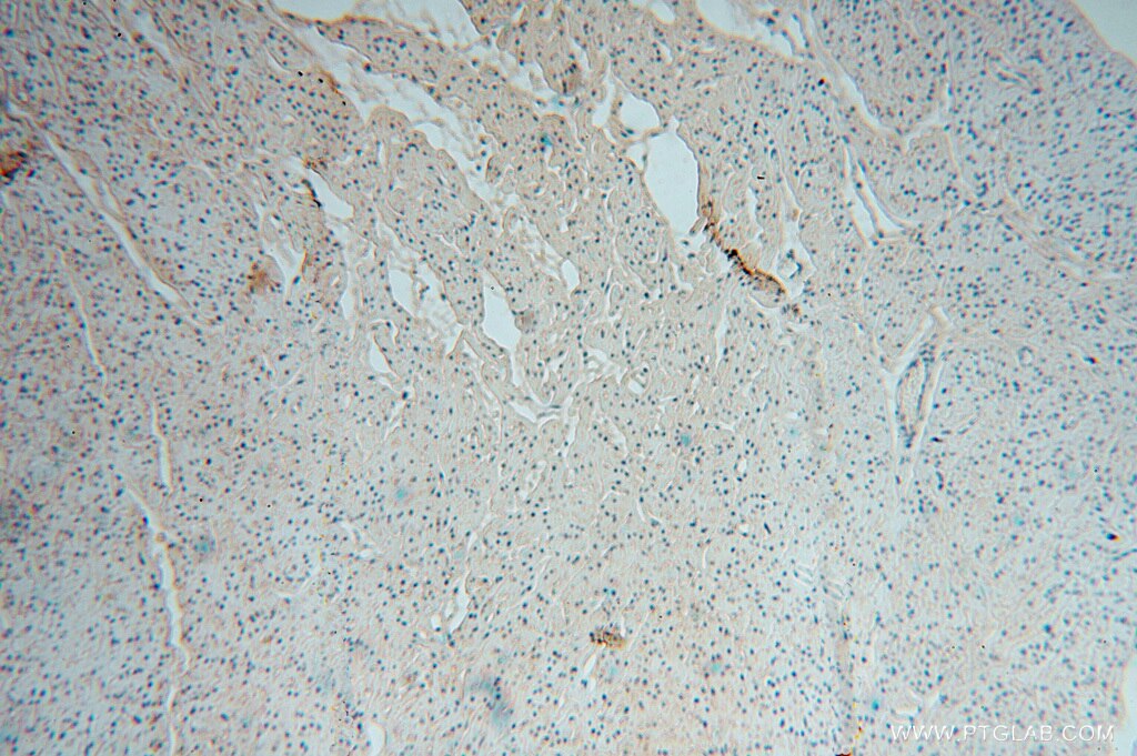 IHC staining of human heart using 11378-1-AP