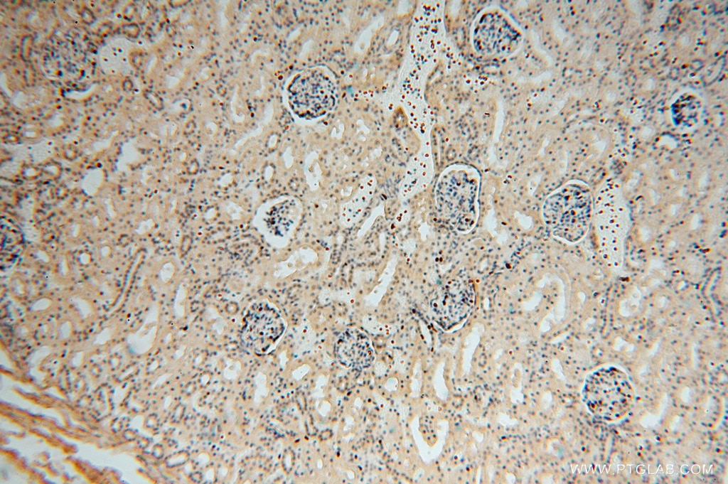Immunohistochemistry (IHC) staining of human kidney tissue using CD36 Polyclonal antibody (11378-1-AP)