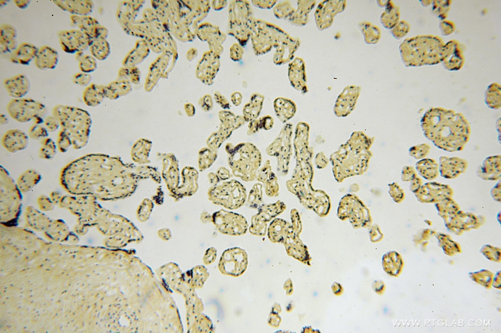 Immunohistochemistry (IHC) staining of human placenta tissue using CD36 Polyclonal antibody (11378-1-AP)