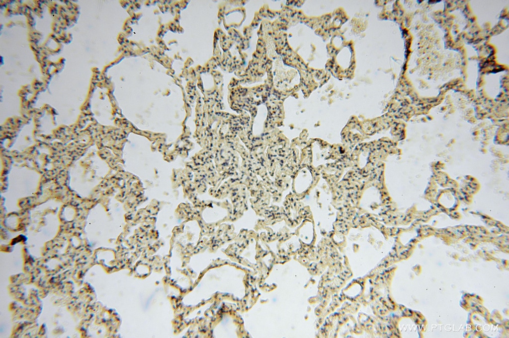 Immunohistochemistry (IHC) staining of human lung tissue using CD36 Polyclonal antibody (11378-1-AP)