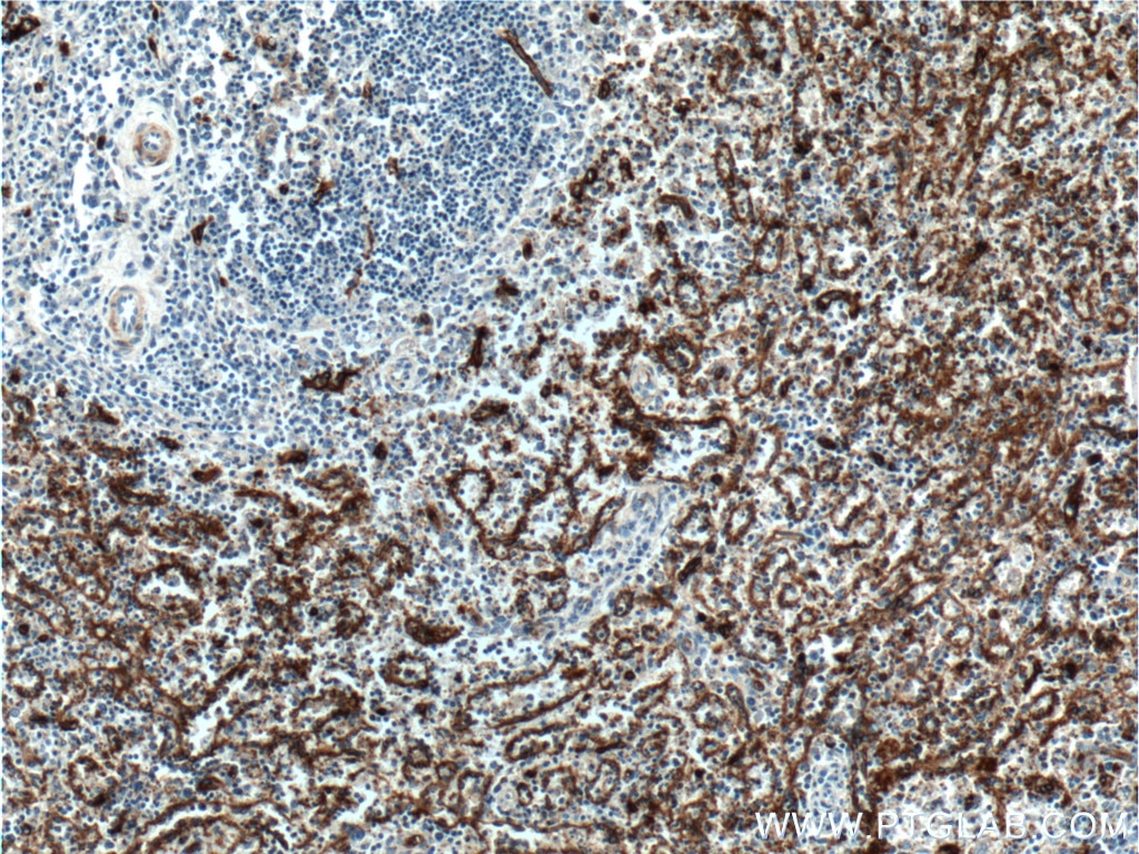 Immunohistochemistry (IHC) staining of human spleen tissue using CD36 Polyclonal antibody (18836-1-AP)