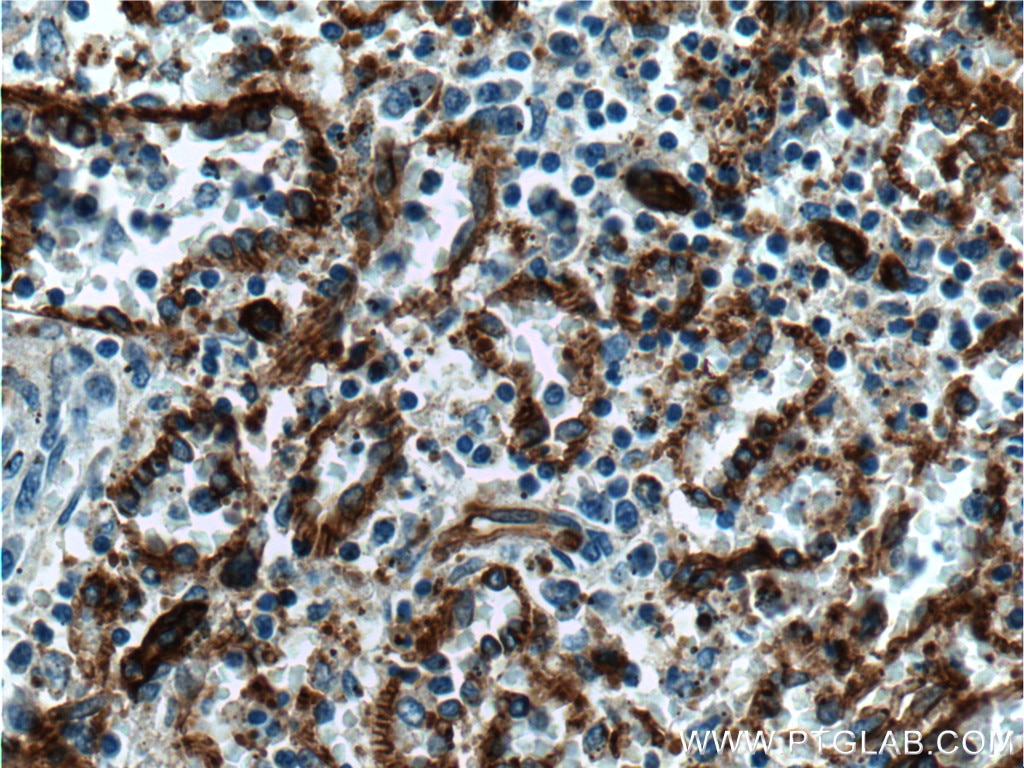 Immunohistochemistry (IHC) staining of human spleen tissue using CD36 Polyclonal antibody (18836-1-AP)