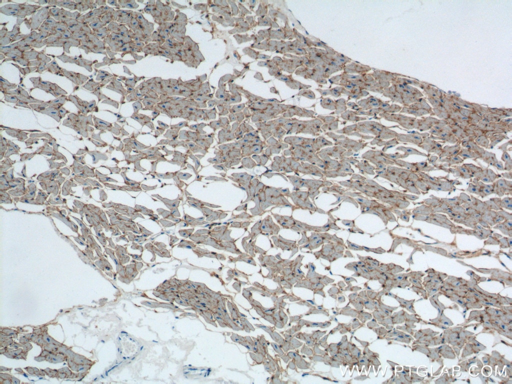 Immunohistochemistry (IHC) staining of human heart tissue using CD36 Polyclonal antibody (18836-1-AP)