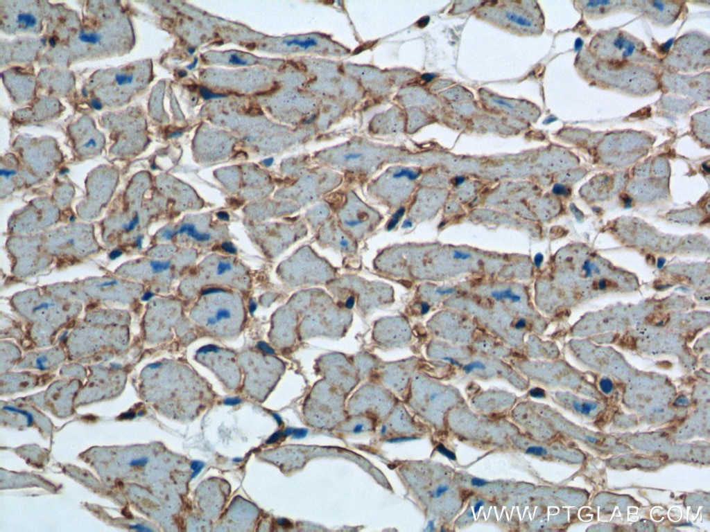 Immunohistochemistry (IHC) staining of human heart tissue using CD36 Polyclonal antibody (18836-1-AP)